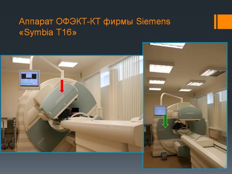 Что такое однофотонная эмиссионная компьютерная томография