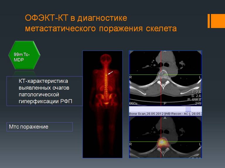 После компьютерной томографии болит голова почему