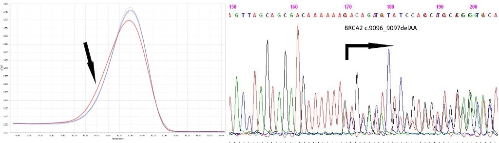 Анализ крови на мутацию гена brca thumbnail