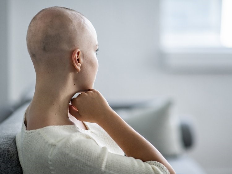 Выпадение волос может быть симптомом рака