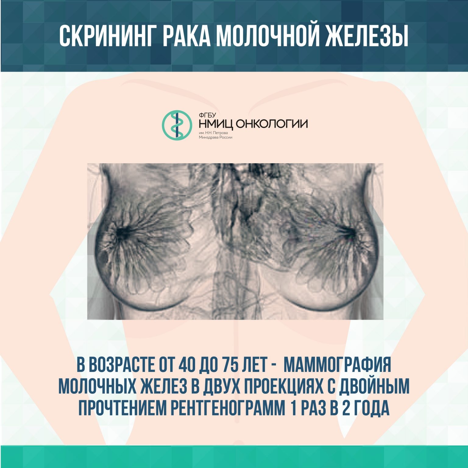 рак груди симптомы у женщин в менопаузе фото 112