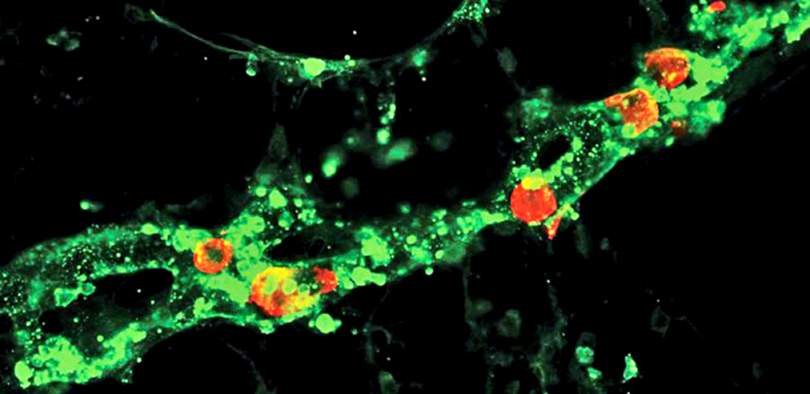 Иммунофлюоресцентная визуализация метастатических клеток меланомы