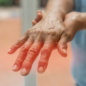 Синдром «перчаток и носков»: что такое полинейропатия и как снизить риск ее развития у онкопациентов