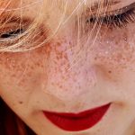 Почему рыжие и блондины больше расположены к раку кожи?